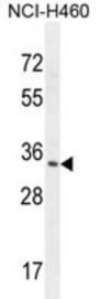 RNT2 Antibody