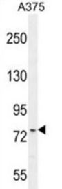 Ankyrin Repeat Domain-Containing Protein 44 (ANR44) Antibody
