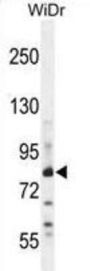 Zinc Finger Protein 180 (ZN180) Antibody