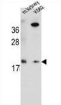 RN185 Antibody