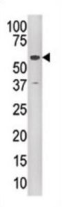 KAT5/Tip60/HTATIP Antibody
