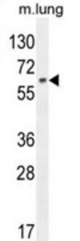 Nuclear Factor Erythroid 2-Related Factor 1 (NFE2L1) Antibody