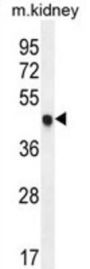 Cyclin Dependent Kinase Inhibitor 1C (CDKN1C) Antibody