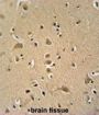WIPF2 Antibody
