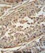 F-Box Only Protein 24 (FBXO24) Antibody