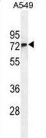 F-Box Only Protein 24 (FBXO24) Antibody