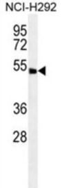 ABHD8 Antibody