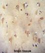 LRC40 Antibody