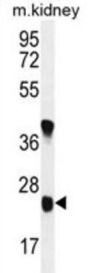 Protein Unc-119 Homolog B (U119B) Antibody