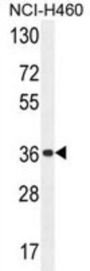OR4A47 Antibody