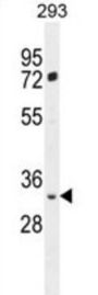 FRG2B Antibody