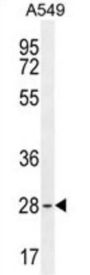 Transcription Factor BTF3 (BTF3) Antibody