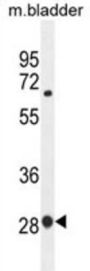 Transcription Factor BTF3 (BTF3) Antibody