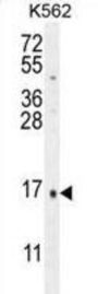 CALCA Antibody