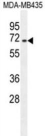 Splicing Factor, Arginine/serine-Rich 17A (SFRS17A) Antibody