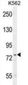 Urocanate Hydratase (UROC1) Antibody