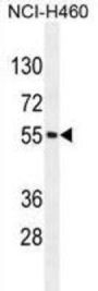 Mesoderm Induction Early Response Protein 2 (MIER2) Antibody