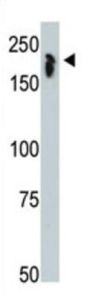 NCOR1 Antibody