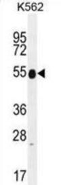 Keratin 25 (KRT25) Antibody