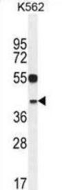 YOD1 Deubiquitinase (YOD1) Antibody