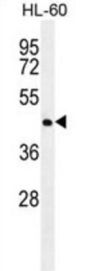 Nuclear Receptor Subfamily 6 Group A Member 1 (NR6A1) Antibody