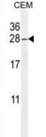 ADP-Ribosylation Factor-Like Protein 8 (ARL5B) Antibody