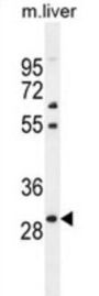Paired Like Homeobox 2b (PHOX2B) Antibody