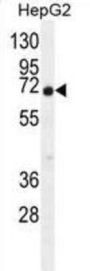 Uncharacterized Protein C11orf95 (C9JLR9) Antibody