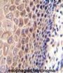 CCDC97 Antibody
