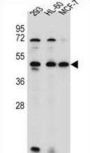 Ankyrin Repeat Domain-Containing Protein 40 (ANKRD40) Antibody