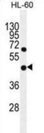 GDPD1 Antibody