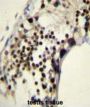 Rac-GTPase Activating Protein 1 (RACGAP1) Antibody