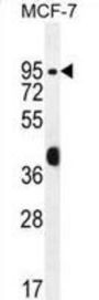 Rac-GTPase Activating Protein 1 (RACGAP1) Antibody