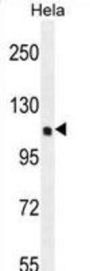 Serine/threonine-Protein Kinase QSK (KIAA0999) Antibody