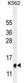 HBB Antibody