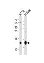 HBB Antibody