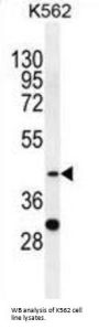 Serpin B4 (SPB4) Antibody