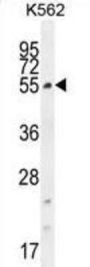 Coiled-Coil Domain-Containing Protein 61 (CCDC61) Antibody