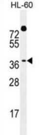 Double Homeobox Protein 4 (DUX4) Antibody