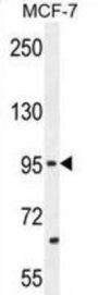 Protocadherin 20 (PCDH20) Antibody