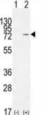 Nucleolin (NCL) Antibody