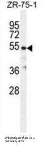 Tubulin Beta-1 Chain (TBB1) Antibody