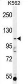 Cytosolic Carboxypeptidase 5 (AGBL5) Antibody