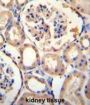 Purine Rich Element Binding Protein A (PURA) Antibody