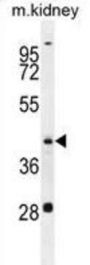Putative Aspartate Aminotransferase, Cytoplasmic 2 (GOT1L1) Antibody