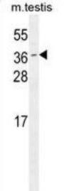 ODF3 Antibody