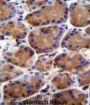 LRWD1 Antibody