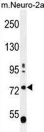 LRWD1 Antibody