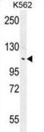 ANKRD18B Antibody