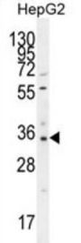 Olfactory Receptor 52I2 (OR52I2) Antibody